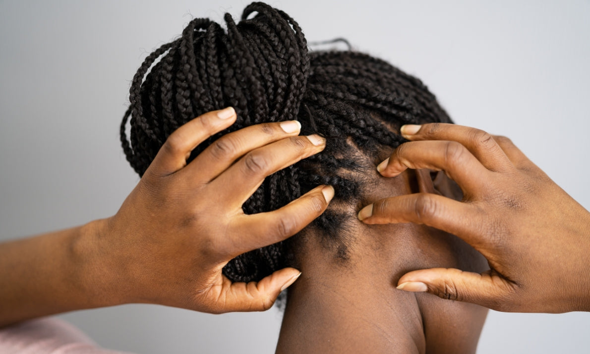 Wigs for the sensitive scalp